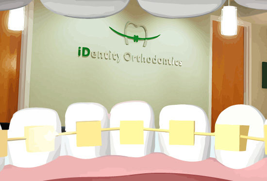 lingual braces at id orthodontics