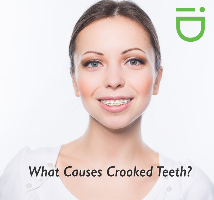 What-Causes-Crooked-Teeth