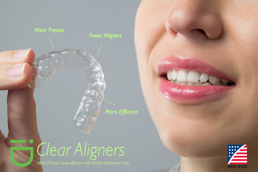 iD Clear Aligners