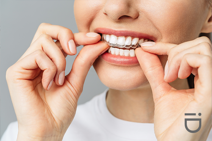 Get invisalign treatment only through board certified orthodontists
